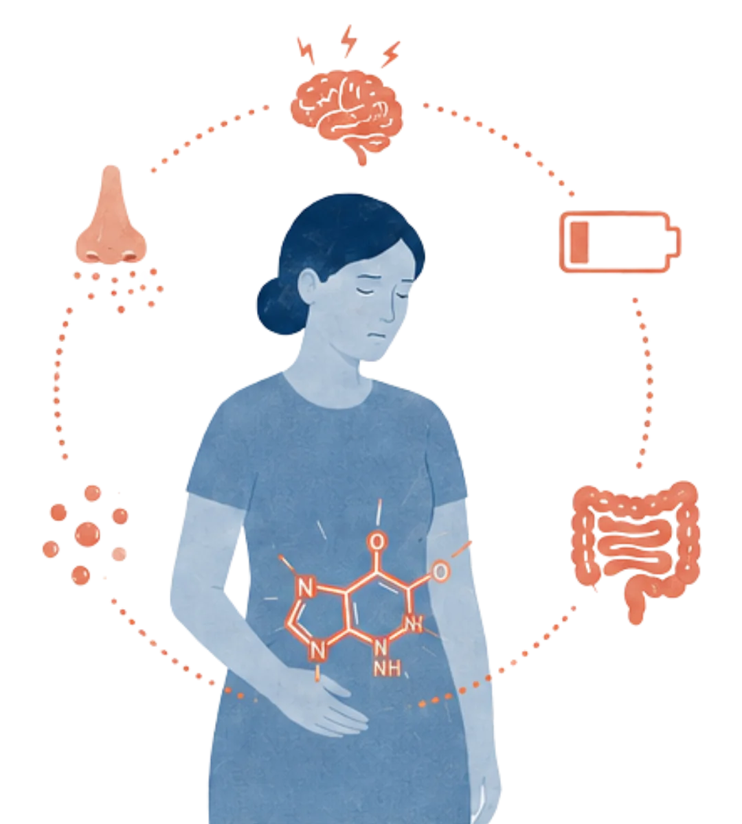 Mujer con síntomas de histamina: migraña, rinitis, distensión, fatiga